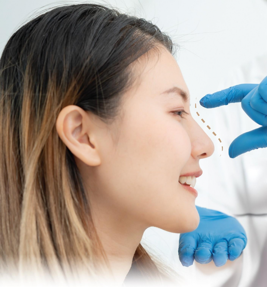Rhinoplasty