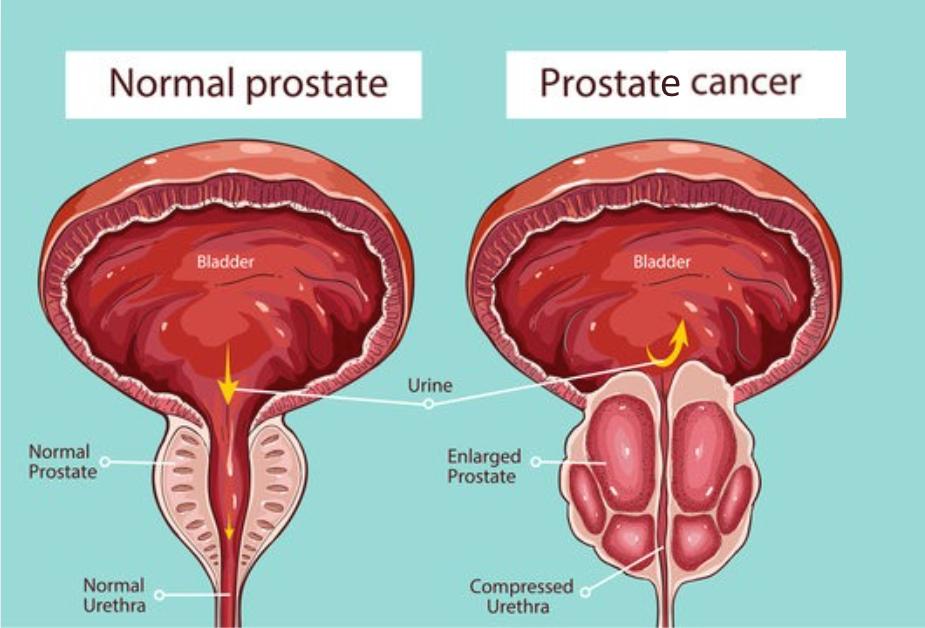 From Avoidance to Action: What It’s Really Like to See a Urologist.
